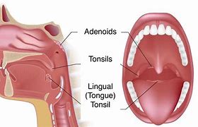Image result for adenoloh�a