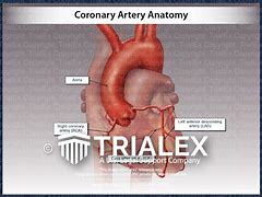 Image result for RCA Artery