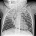 Image result for Diaphragm Pain Symptoms