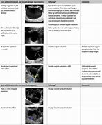 Image result for Ovarian Cyst Post Menopausal