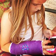 Image result for Arm Cast Covers for Kids