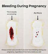Image result for What Does Pregnancy Bleeding Look Like