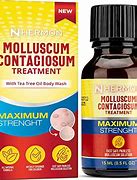 Image result for Toddler Molluscum