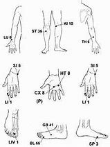 Image result for ECIWO Acupuncture Points Chart