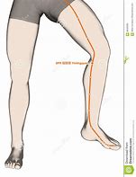 Image result for Acupuncture Drawing