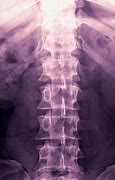Image result for L1 S1 Spine