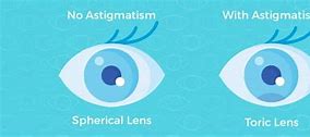Image result for Toric Contact Lenses Yellow Box