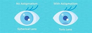 Image result for Toric Contact Lenses for Astigmatism