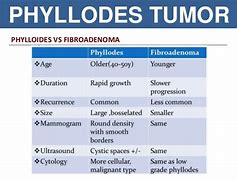 Image result for Phyllodes Tumor vs Fibroadenoma