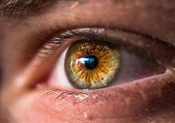 Image result for Unusual Natural Eye Colors