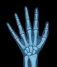 Image result for X-ray Vector