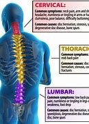Image result for Lumbar Pain Chart