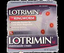 Image result for Best Antifungal Cream for Ringworm