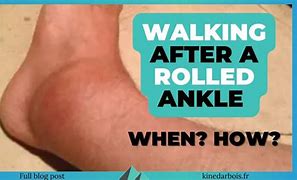 Image result for Rolled Ankle Funny PUC