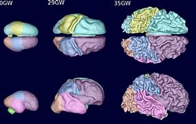 Image result for Baby Brain Map