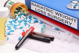 Image result for Bariatric Surgery Weight Loss