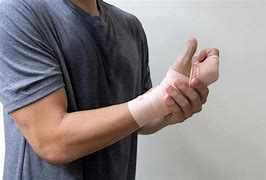 Image result for Broken Arm Hand