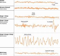 Image result for Brain Activity during Sleep
