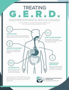 Image result for Pharmacy Ad On Gerd