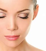 Image result for Cosmetic Surgery Procedure
