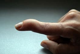 Image result for Broken Tip of Finger