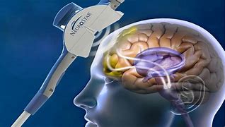 Image result for Brain Therapy