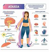 Image result for atasia