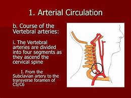 Image result for Vertebral Artery Origin