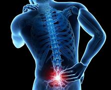 Image result for Chiropractic Backache