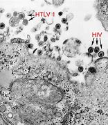 Image result for Aids Virus Cell