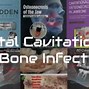Image result for Jaw Bone Infection
