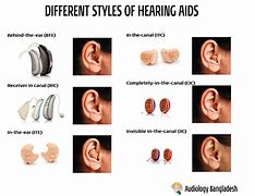 Image result for Jawbone Hearing Aids