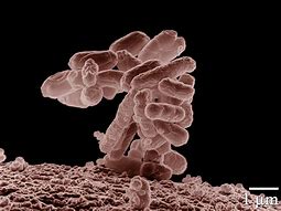 Image result for colibacilo