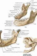 Image result for Healthy Jawbone