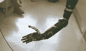 Image result for Upper Limb Prosthetic Devices