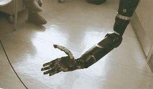 Image result for Prosthetic Arm Designs