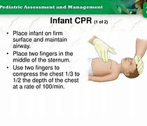 Image result for Neonatal CPR