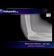 Image result for PVC Elbow Joint