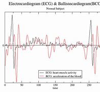 Image result for ballistocardiogram graphs
