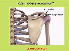 Image result for acrominaci�n