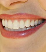 Image result for Smiling Teeth