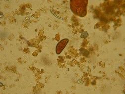 Image result for "red-scale-parasite"