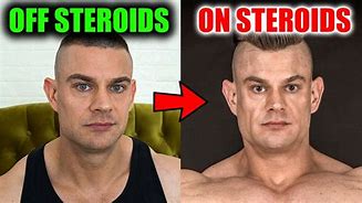 Image result for Before and After Using Steroids