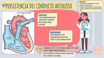 Image result for arterioso