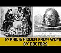 Image result for Syphilis 1800s