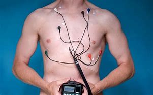 Image result for Philips Cardiac Monitor