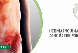 Image result for herniario