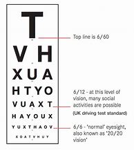 Image result for 20 20 Eye Chart Test