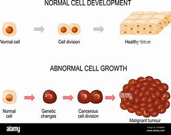 Image result for Cancer Cell Formation