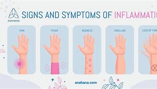 Image result for 5 Signs of Inflammation